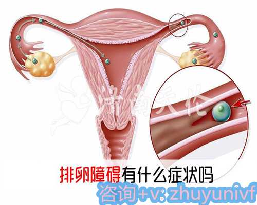 打排卵针后同房的注意事项